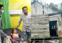 Ada Anak Penderita Bibir Sumbing dan Rutilahu, Kecamatan Tatah Makmur Klaim Tidak Tutup Mata